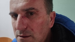 Pretučen aktivista SDS